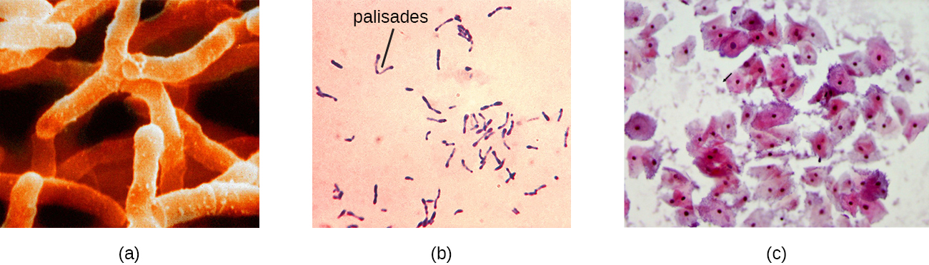 a) A micrograph of branched cells. B) A micrograph of cells arranged in a V-shape – these are labeled palisades. C) A micrograph of corn-flake shaped cells with a nucleus. Smaller cells outside of these are identified with an arrow.