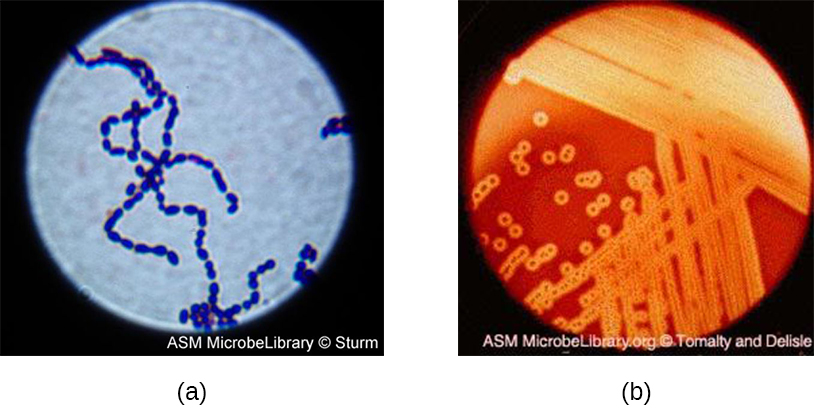 a) Una micrografía de células esféricas en una cadena. B) Una fotografía de colonias en agar. El agar es rojo, y hay un claro alrededor de cada colonia.