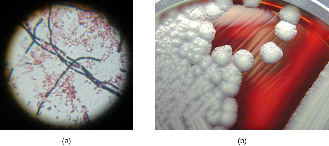a) Una micrografía de células en forma de bastón en una cadena. B) Una fotografía de colonias en agar. El agar es rojo y las colonias son blancas y de aspecto esponjoso.