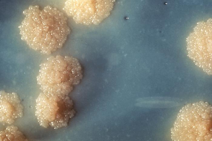 Fotografía de colonias en agar. El agar es azul y las colonias parecen un montón de cuentas.