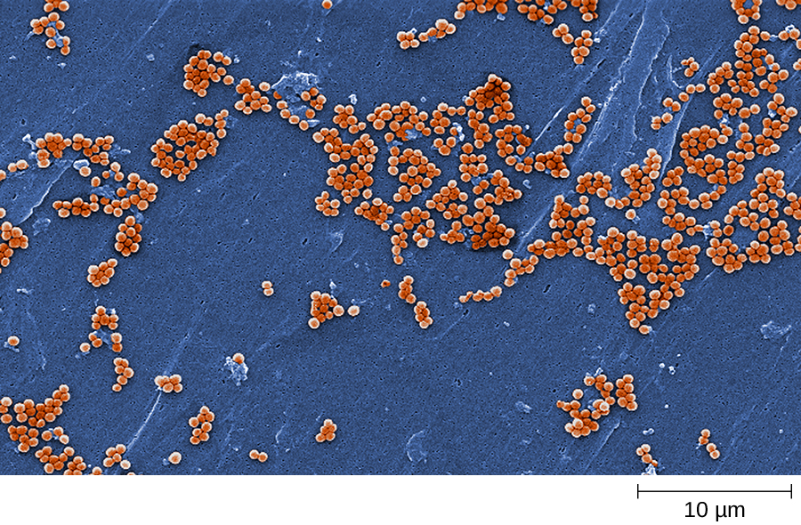 Micrografía que muestra racimos de células esféricas.