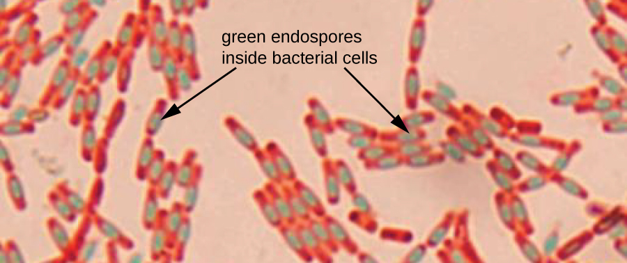 Microscope image showing green endospores within rod-shaped bacteria.