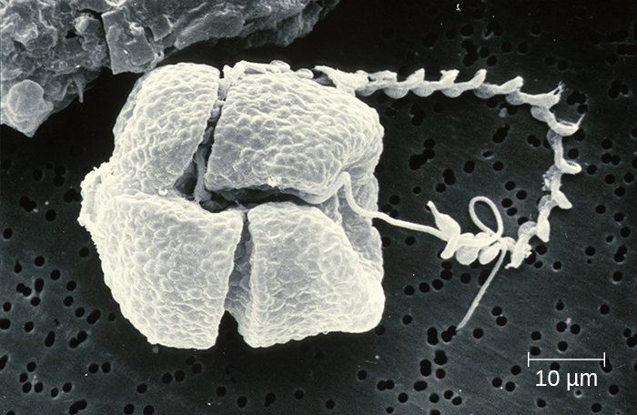 A micrograph of a square-shaped organism with two long projections.