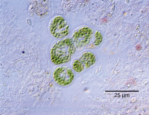 Round colonies of blue-green algae are shown at 300 times magnification under a light microscope. Each algae cell is about 5 microns across. 