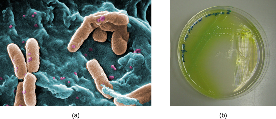 a) a micrograph of rod shaped cells. B) An agar plate with a green pigmented colonies; this green pigment is spreading past the edge of the colonies.