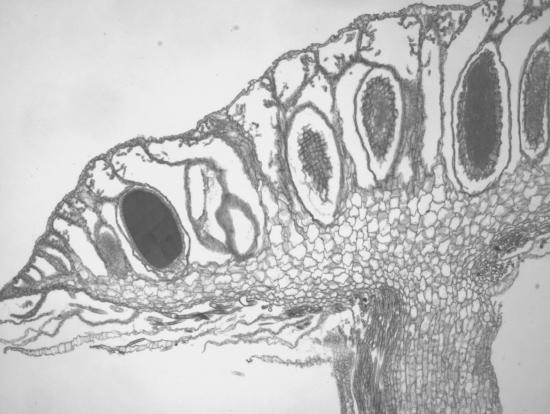 Antheridia are visible as dark elongated sacs, shaped almost like footballs on the top of the antheridiophore