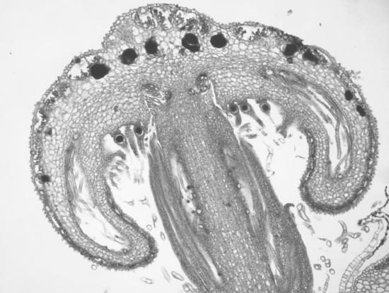 Archegonia are visible emerging from the underside of the palm tree-like branches of the archegoniophore. An egg is present at the base of each upside down, vase-like archegonium.