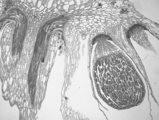 The sporophyte emerges upside down from the archegonium. Spores are visible in chains within the sporangium, surrounded by elaters. There is a small fleshy area at the base of the sporangium. This is the seta.