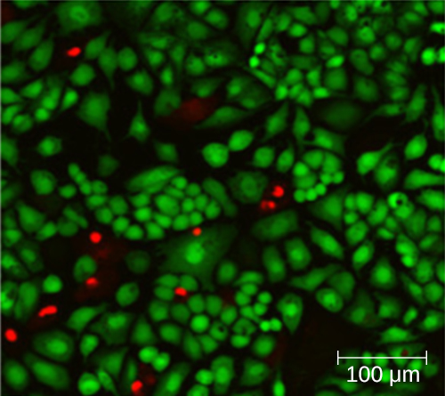 A micrograph of many glowing green cells and some glowing red cells.