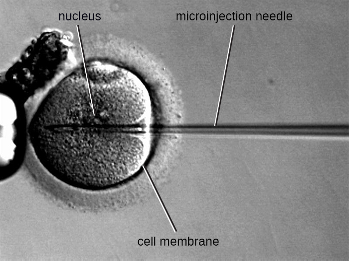 Micrograph ya sindano ya microinjection inayopitia kupitia membrane ya plasma ya seli na ndani ya kiini.