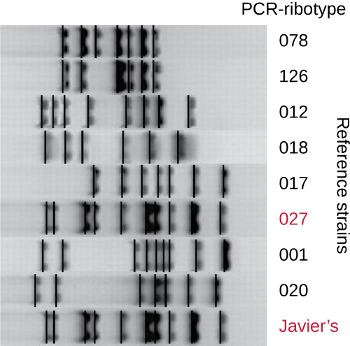 A gel showing various bands of various PCR-ribotypes. The bottom lane is labeled Javier’s an matches the banding pattern from PCR-ribotype 027.