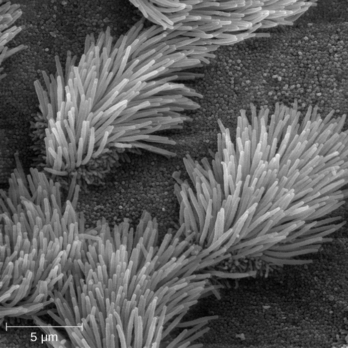 A spongy-looking surface with tufts of long hairs. Each hair is about 5 µm long; each tuft is about 10 µm in diameter.