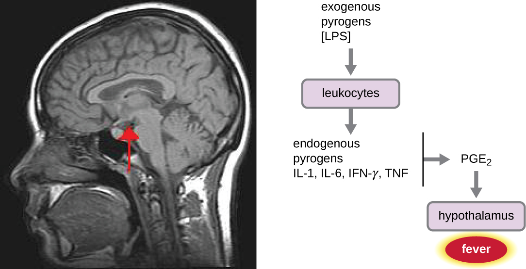 A diagram with exogenous pyrogen at the top. These activate leukocytes which in turn release IL-6. The leukocytes also produce pyrogenic cytokines (IL-1, TNF-α, IFN-γ) which lead to the production of IL-6. IL-6 signals the circumventricular organs of the brain to produce PGE2 which results in fever. The temperature dependent feedback on cytokine expression decreases the production of IL-6 in a negative feedback loop.