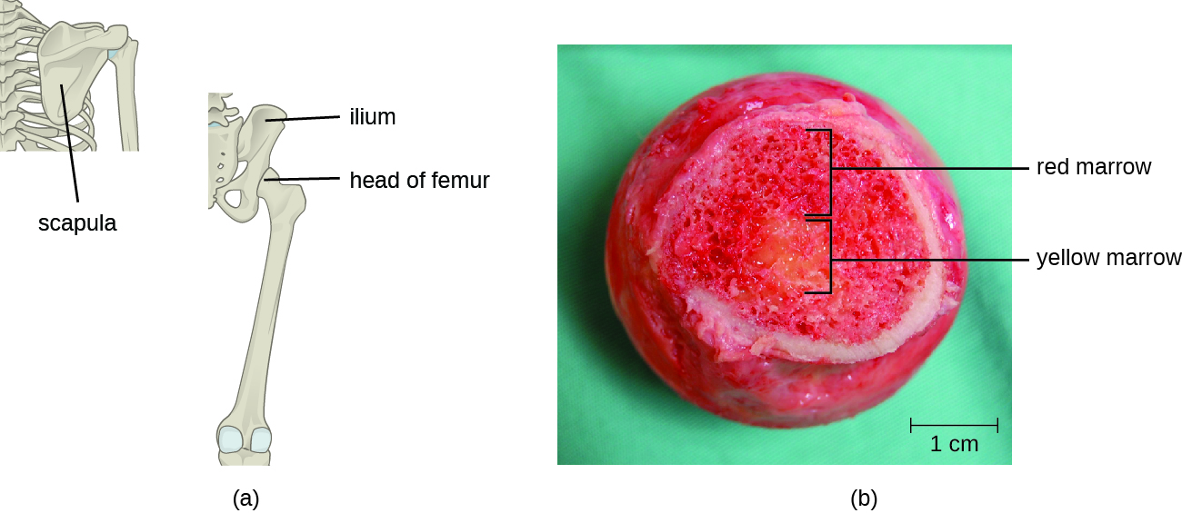 a) A drawing of a femur; a long bone with a round head. B) A cross section of the head of the femur.