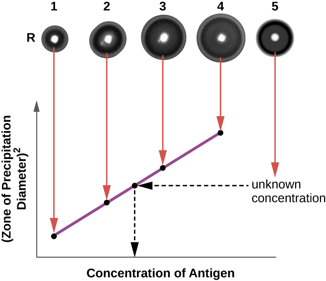 At the top is a photograph of 4 clear dots in a row. Dot 1 has a small ring around it, dot 2 has a larger ring, dot 3 has a larger ring, and dot 4 has an even larger ring. These have arrows leading to a graph that shows that the size of the ring (zone of precipitation diameter)  relates to the concentration of antigen. The lower antigen concentration results in a smaller ring.  Another dot (#5) off to the side contains an unknown antigen concentration. The size of the ring is measured and used to find the concentration of antigen. This is done by finding the ring size on the line from the graph and connecting that to the X-axis to find the concentration of antigen.