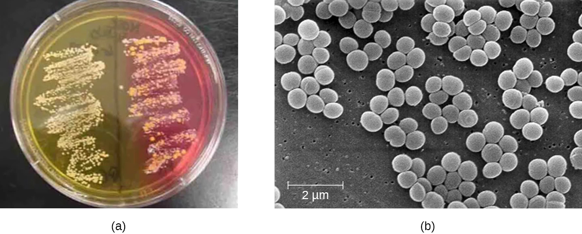 a) Una placa de agar con 2 regiones de crecimiento. Una región tiene un fondo amarillo, la otra tiene un fondo rosa. B) Una micrografía de racimos de células redondas. Cada celda tiene poco menos de 1 µm de diámetro.