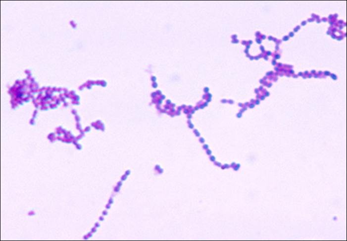 Se muestra una micrografía de Streptococcus pyogenes.
