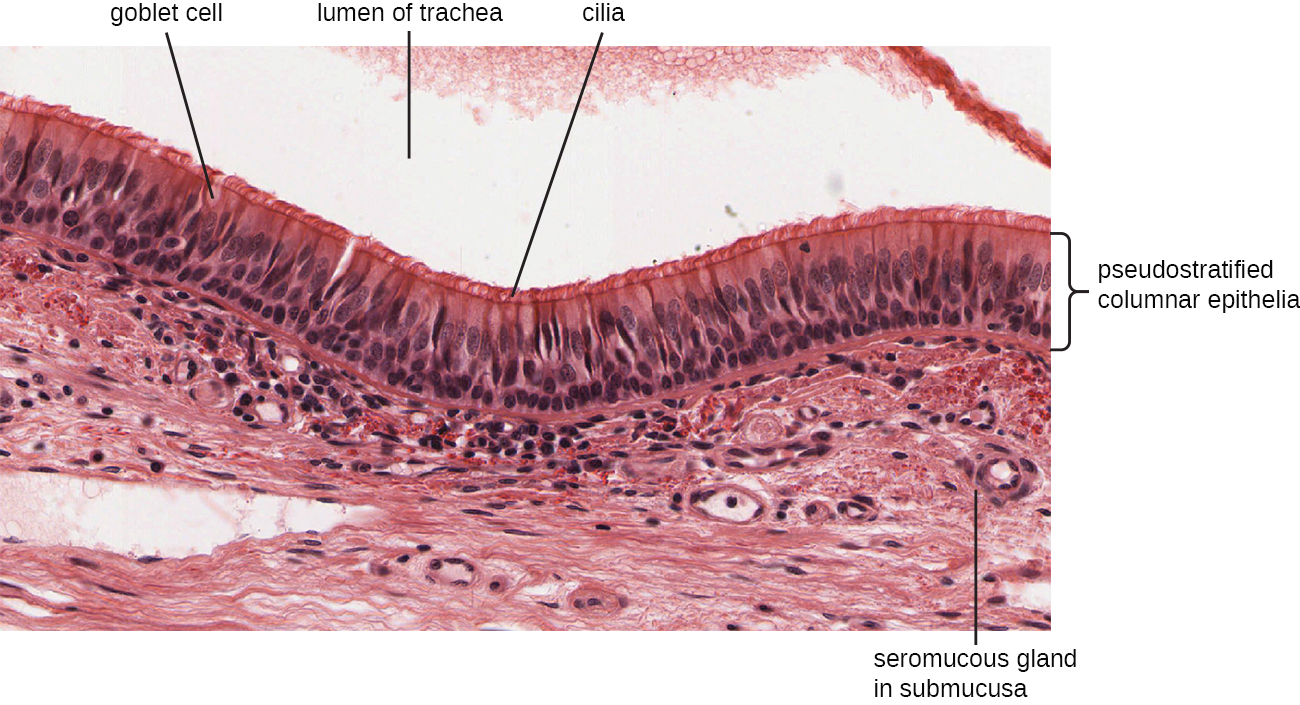 A micrograph showing a space at the top labeled lumen of trachea. Underneath this are long cells with a brush border at the top. These cells are called pseudostratified columnar epithelia. The brush border is many cilia. Vase shaped cells in this layer are called goblet cells. Below this layer is tissue with small spheres labeled seromucous gland in submucosa.