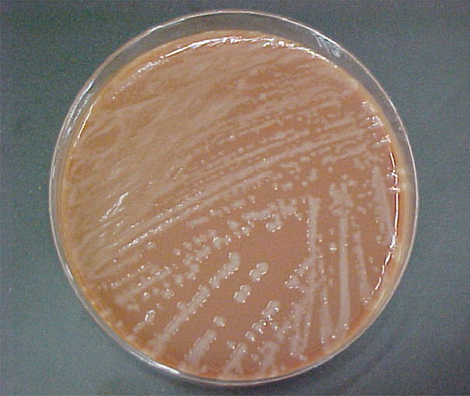 A micrograph of Haemophilus influenzae is shown. It looks like a brown disc with white streaks.