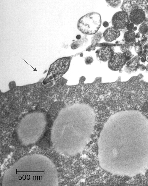 OSC_Microbio_22_02_Mycoplasma.jpg