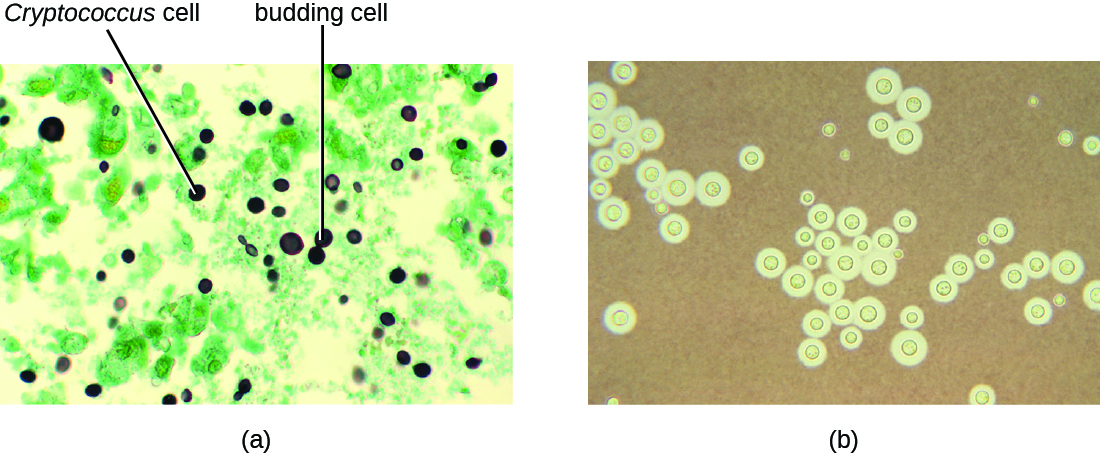 a) A micrograph with dark circles (some attached to form a figure 8) on a green background. The dark cells are labeled Cryptococcus. The figure 8 cells are labeled budding cells. b) a negative stain micrograph of cryptococcus neoformans is shown. It appears as green spots on a brown background.