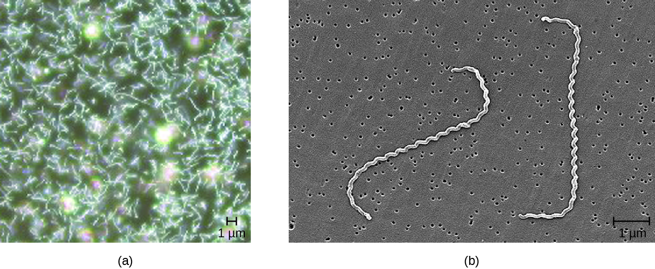 (a) Micrograph of many spiral shaped cells. (b) Higher magnification showing spiral shape more clearly.