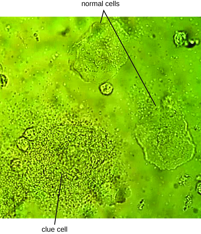 Micrograph ya seli kubwa za binadamu na seli ndogo za bakteria.