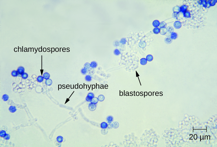 a) micrograph showing long strands with dark blue spheres labeled chlamydospores on the tips of the strands. Smaller clear spheres in clusters on the strand are labeled blastospores.
