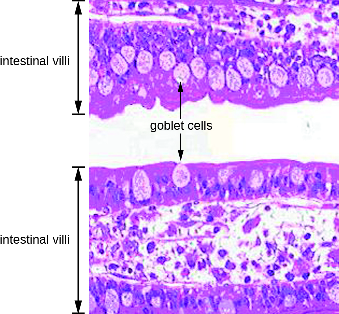 Micrograph of intestinal villi which are 2 pink regions separated by a clear space. The surface of each pink band is darker pink than the center and the surface contains lighter pink oval cells labeled goblet cells.