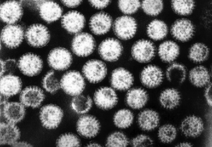 OSC_Microbio_24_04_Rotavirus.jpg