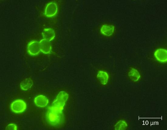 Micrograph of green glowing circles on a dark background.