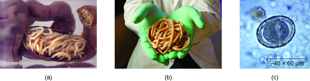 a) phot of worms filling the intestines. B) photo of a large handful of worms. C) photo of a circle in a thicker circle. The outer circle is about 60 micrometers.