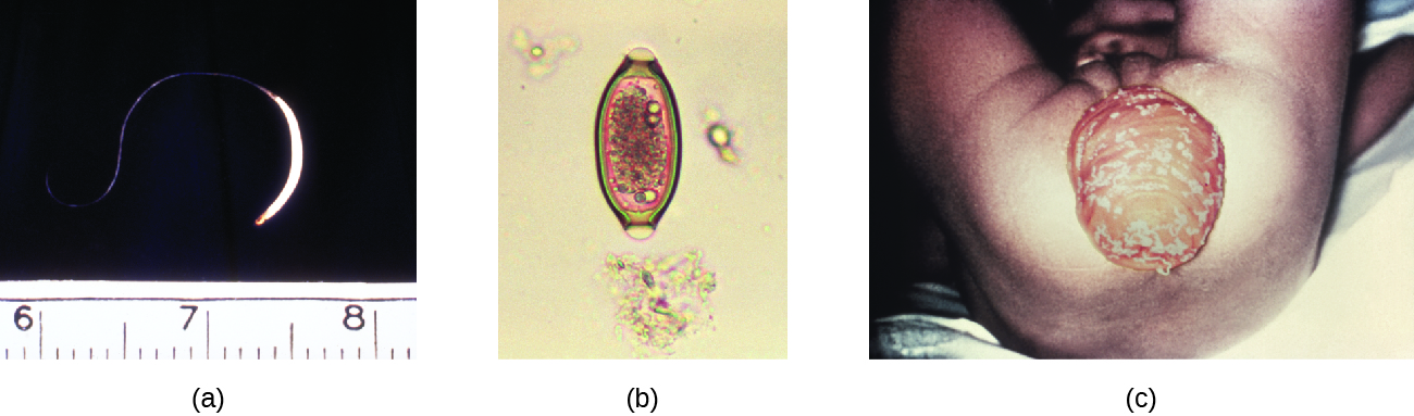 a) a micrograph of a worm about 2 inches in length. B) a micrograph of an oval cell. c) A photo of a large protruding sac from the anus.