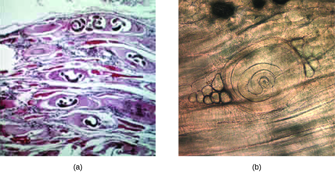a) a micrograph of worms in bubbles within muscle tissue. B) a micrograph of a coiled worm on muscle.