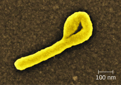 OSC_Microbio_25_03_Ebola.jpg