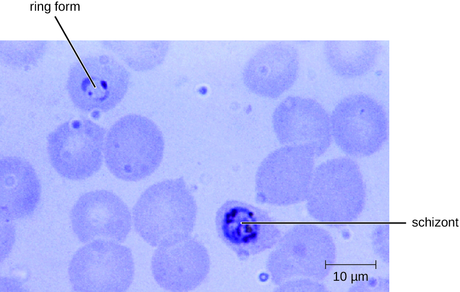 A micrograph showing red blood cells. A dark ring in the center of one cell is labeled ring form. A larger dark region in another cell is labeled schizont.