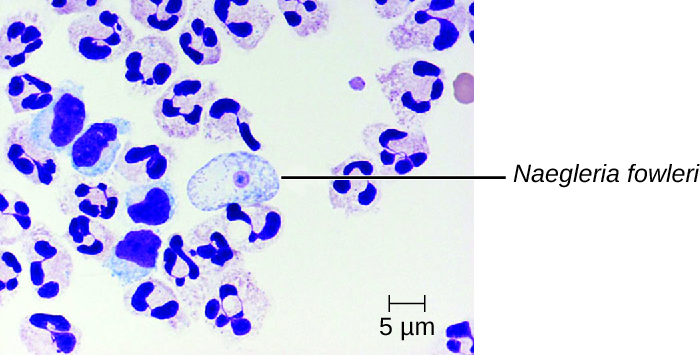 Micrograph of white blood cells and a large cell with a small circle in the center labeled N. fowlerii.