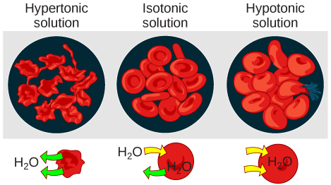 Ilustración de glóbulos rojos en soluciones hipotónicas, isotónicas e hipertónicas. En la solución hipertónica, las células se marchitan y toman una apariencia puntiforme. En la solución isotónica, las células son de apariencia normal. En la solución hipotónica, las células se hinchan y una se ha roto.