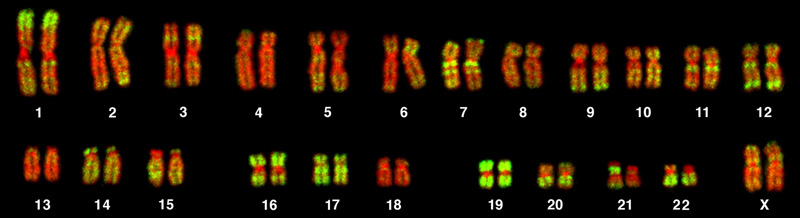 Este es un cariotipo de una hembra humana. Hay 22 pares homólogos de cromosomas y un par de cromosomas X.