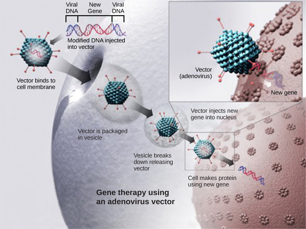 Una ilustración que muestra un virus que contiene ADN viral combinado con un gen sano no mutado. El virus ingresa a la llamada dirigida e inyecta el gen no mutado en el núcleo de la célula diana.