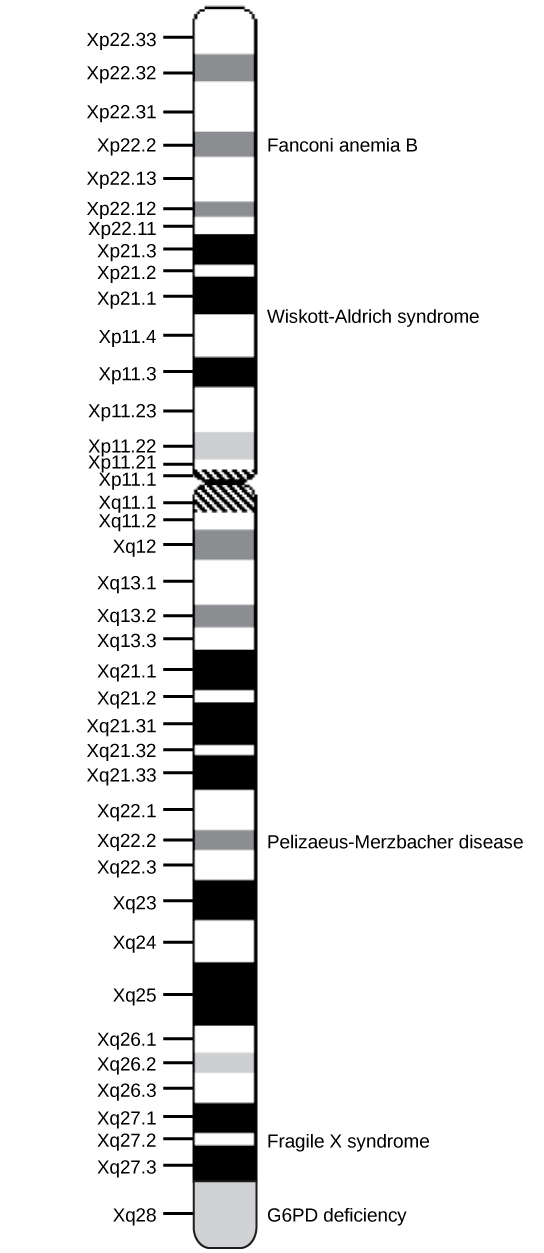 Diagrama que muestra un cromosoma humano con bandas reveladas con una tinción de Giemsa. Las bandas están etiquetadas con Xp y un número en el brazo corto y Xq y un número en el brazo largo. Ciertos genes se encuentran dentro de algunas de las bandas. Estos genes están etiquetados a la derecha: anemia de Fanconi B, síndrome de Wiskott-Aldrich, enfermedad de Pelizaeus-Merzbacher, síndrome del X frágil y deficiencia de G6PD [0].