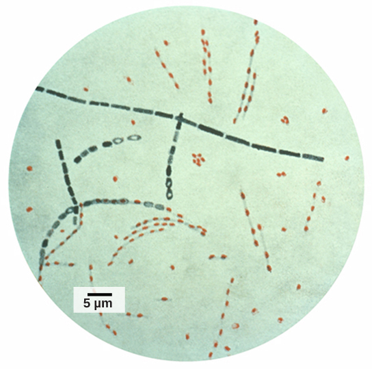 Una foto de microscopio óptico de las largas varillas de la bacteria ántrax. También se pueden ver varias líneas de puntos de esporas rojas.