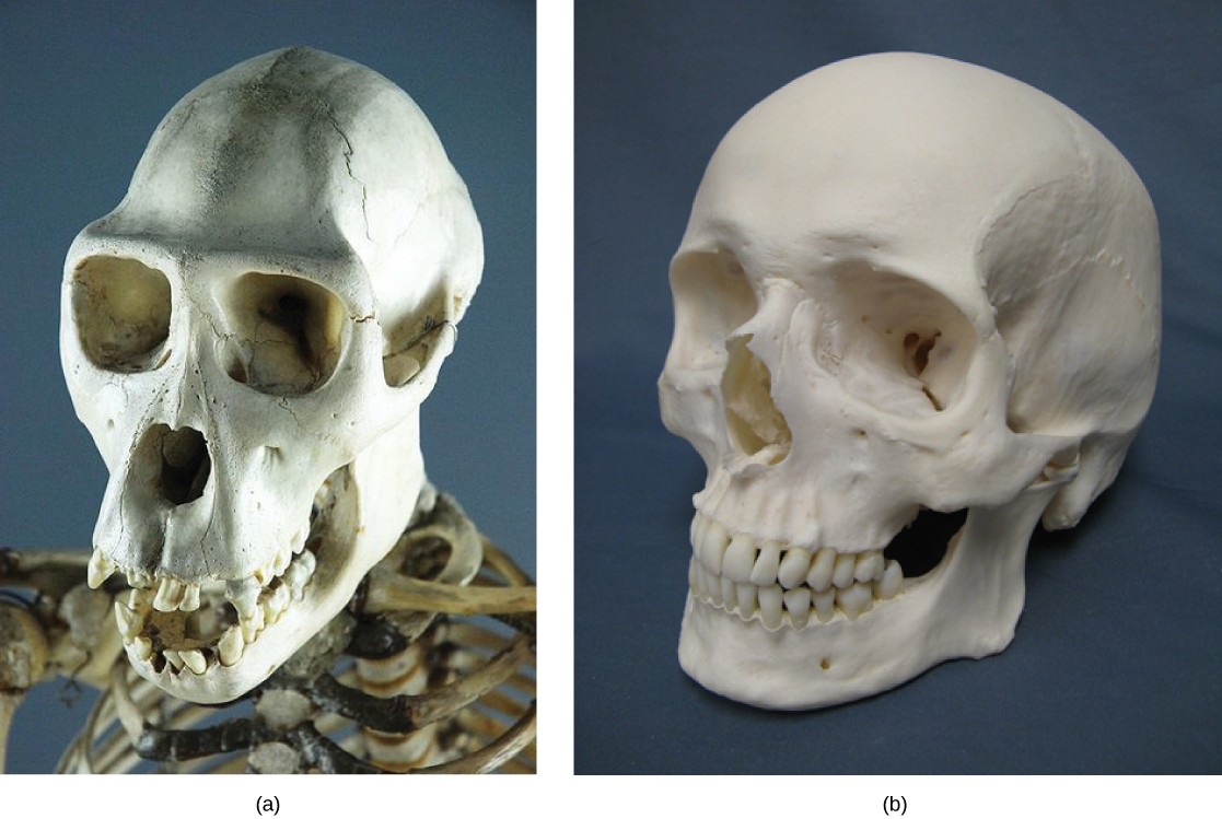 Photo A is of a chimpanzee skull. There is a prominent ridged brow, the eye and nose area is quite flat, and the maxilla and mandible (the jaw) protrude. Photo B is of a human skull. The cranium is proportionately larger than the chimpanzee, the brow is smooth, the nose and cheekbones are more prominent and the mandible and maxilla protrude only slightly.