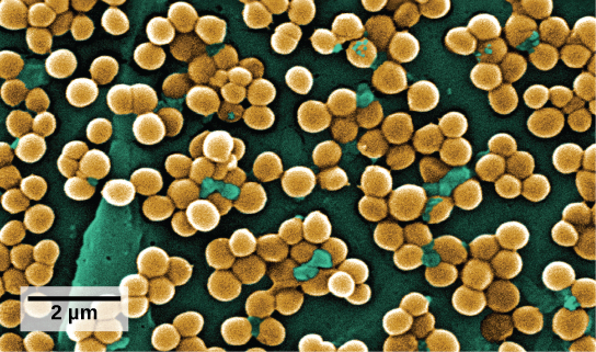 La micrografía electrónica de barrido muestra racimos de bacterias redondas, aferradas a una superficie.