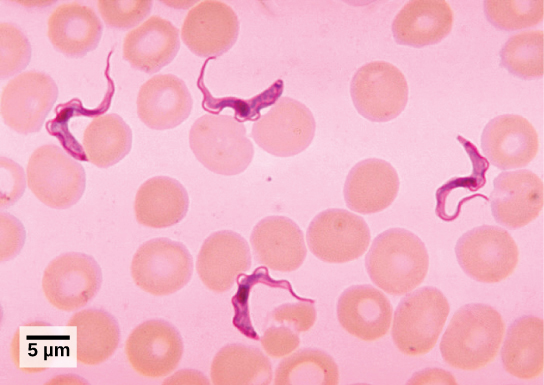 The light micrograph shows round red blood cells, about 8 microns across. Swimming among the red blood cells are ribbon-like trypanosomes. The trypanosomes are about three times as long as the red blood cells are wide.
