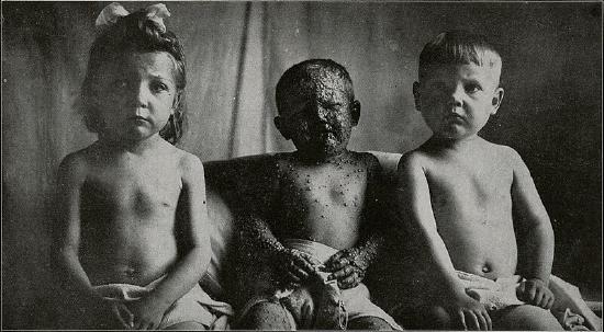 three young children