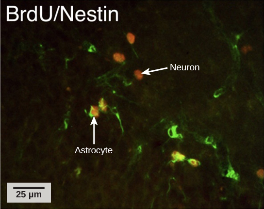 En la micrografía, varias células están marcadas fluorescentemente solo en verde. Tres células están marcadas solo de rojo, y cuatro células están marcadas con verde y rojo. Las células marcadas de verde y rojo son astrocitos, y las células marcadas de rojo son neuronas. Las neuronas son ovales y tienen una longitud aproximada de diez micrones. Los astrocitos son ligeramente más grandes y de forma irregular.