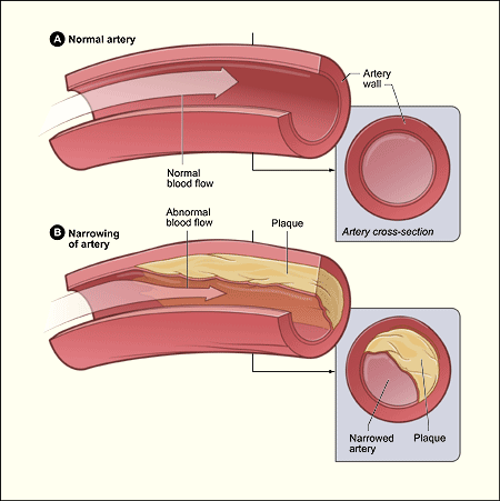 Blood flow labeled diagram