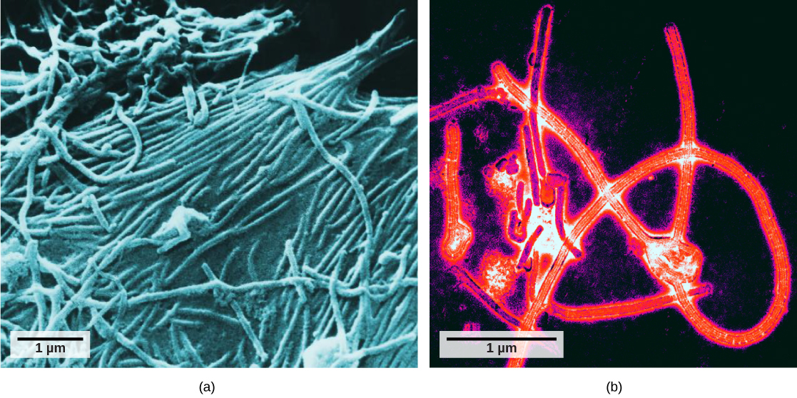 Two photos of the Ebola virus are shown. Photo A is a scanning electron micrograph. There are many three dimensional long, round ended, viruses shown. Photo B is a color enhanced transmission electron micrograph. The viruses are the same size and shape as in photo A, but here some internal structure can be seen in longitudinal cross section.