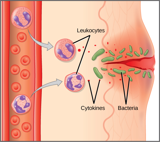 La ilustración muestra un capilar cerca de la superficie de la piel que tiene un corte en él. Las bacterias han penetrado en la piel alrededor del corte. En respuesta, las células de masa en la parte inferior del tejido cutáneo liberan histaminas y las células dendríticas liberan citocinas. Las histaminas hacen que el capilar se vuelva permeable. Los neutrófilos y monocitos salen del capilar hacia la piel dañada. Tanto los neutrófilos como los macrófagos liberan citoquinas y consumen bacterias por fagocitosis.